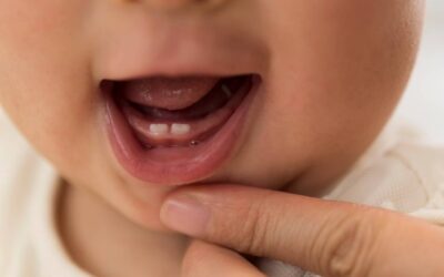 The Ultimate Guide to Baby Teeth: What Every Parent Needs to Know